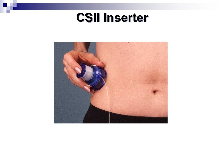 CSII Inserter 