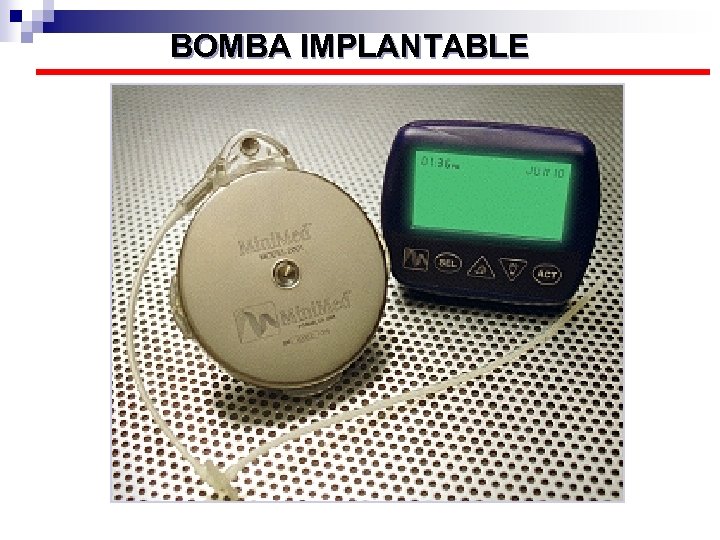 BOMBA IMPLANTABLE 