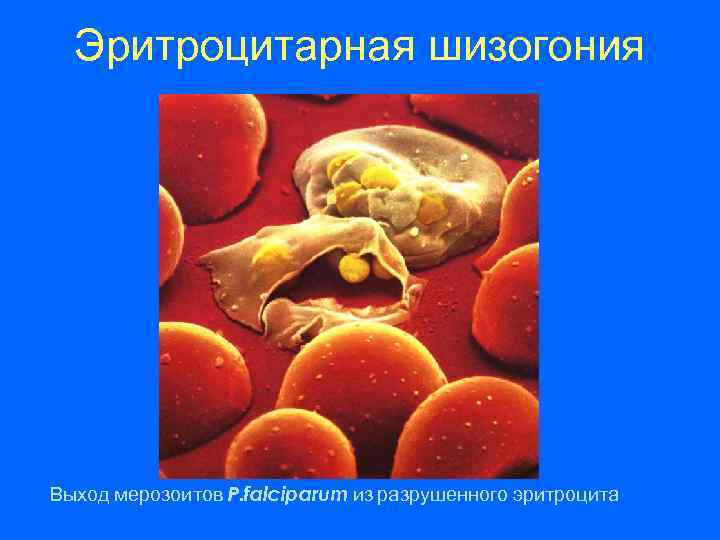 Эритроцитарная шизогония Выход мерозоитов P. falciparum из разрушенного эритроцита 