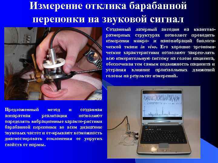 Измерение отклика барабанной перепонки на звуковой сигнал Созданный лазерный автодин на квантоворазмерных структурах позволяет