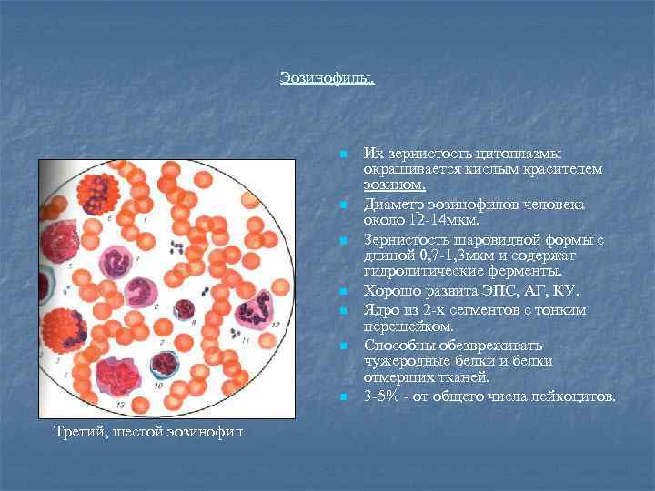 Эозинофилы. n n n n Третий, шестой эозинофил Их зернистость цитоплазмы окрашивается кислым красителем