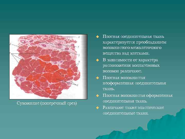 u u Сухожилие (поперечный срез) u Плотная соединительная ткань характеризуется преобладанием волокнистого межклеточного вещества