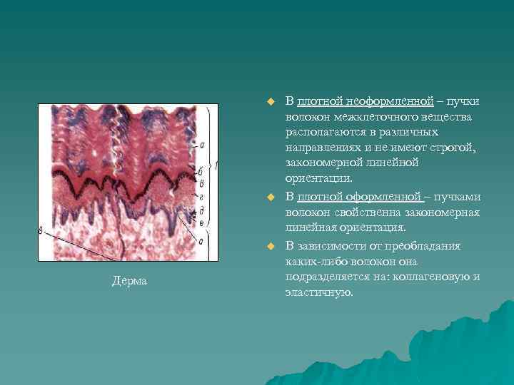 u u u Дерма В плотной неоформленной – пучки волокон межклеточного вещества располагаются в
