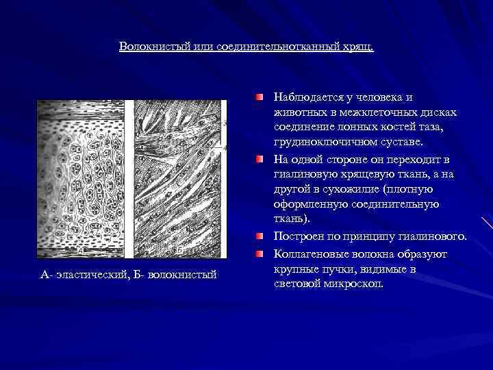 Волокнистый или соединительнотканный хрящ. А- эластический, Б- волокнистый Наблюдается у человека и животных в