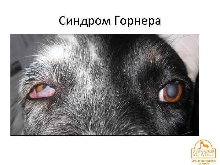 Синдром Горнера 