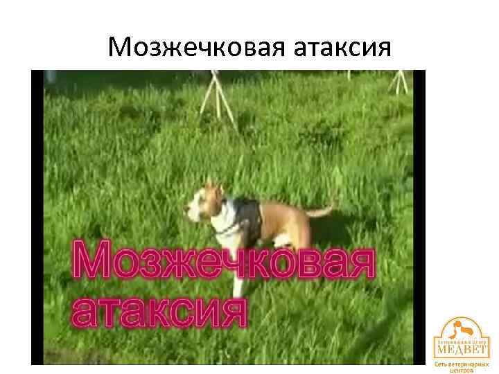 Мозжечковая атаксия 