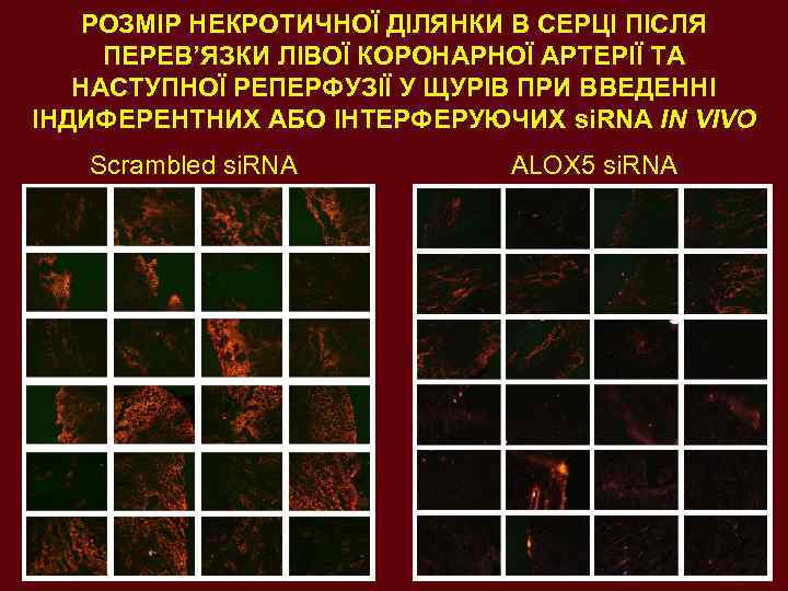 РОЗМІР НЕКРОТИЧНОЇ ДІЛЯНКИ В СЕРЦІ ПІСЛЯ ПЕРЕВ’ЯЗКИ ЛІВОЇ КОРОНАРНОЇ АРТЕРІЇ ТА НАСТУПНОЇ РЕПЕРФУЗІЇ У