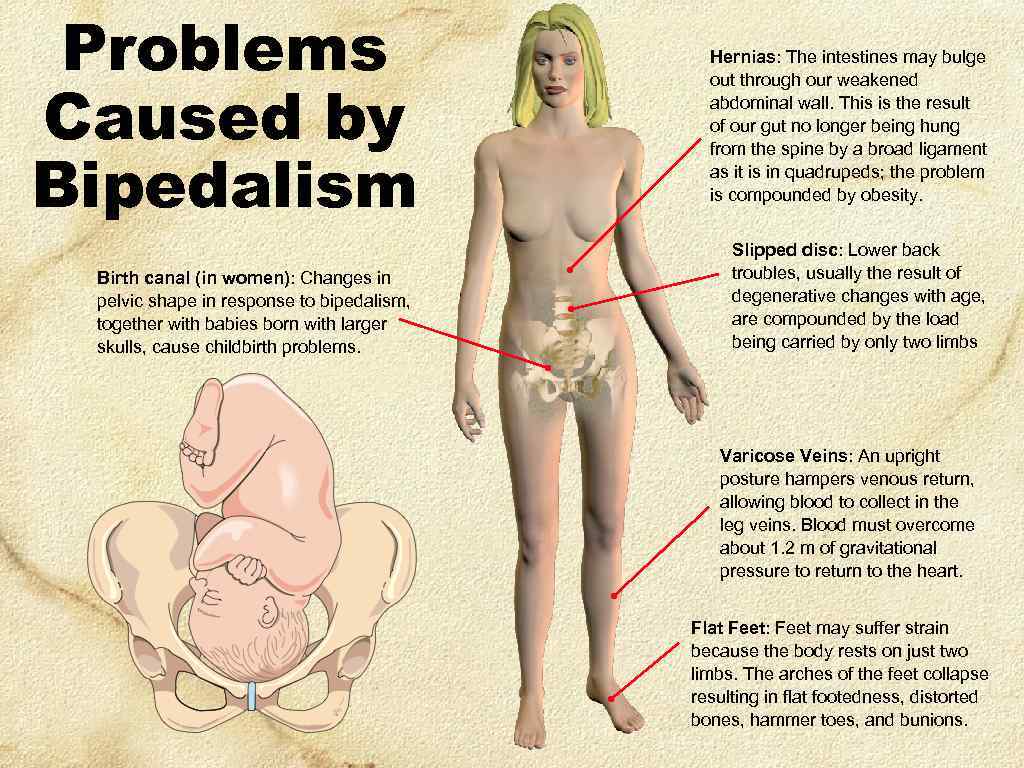 Problems Caused by Bipedalism Birth canal (in women): Changes in pelvic shape in response