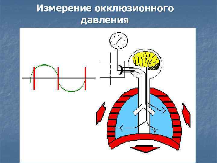 Измерение окклюзионного давления P 100 Pmax. Ex Pmax. In 