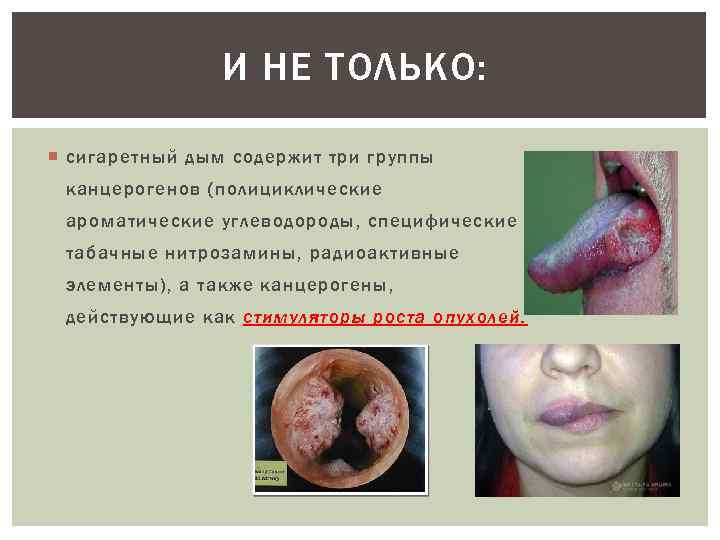 И НЕ ТОЛЬКО: сигаретный дым содержит три группы канцерогенов (полициклические ароматические углеводороды, специфические табачные