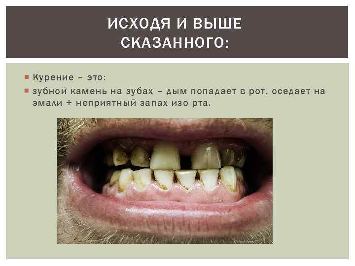 ИСХОДЯ И ВЫШЕ СКАЗАННОГО: Курение – это: зубной камень на зубах – дым попадает