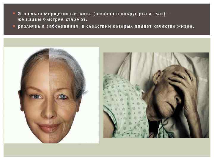  Это вялая морщинистая кожа (особенно вокруг рта и глаз) – женщины быстрее стареют.