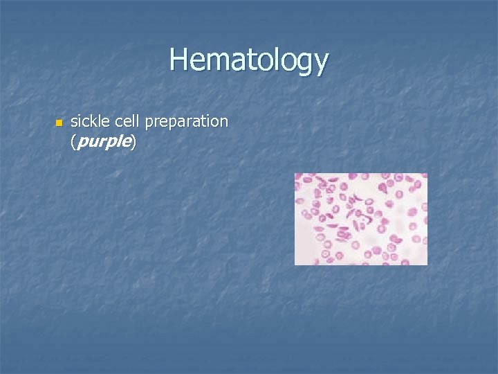 Hematology n sickle cell preparation (purple) 