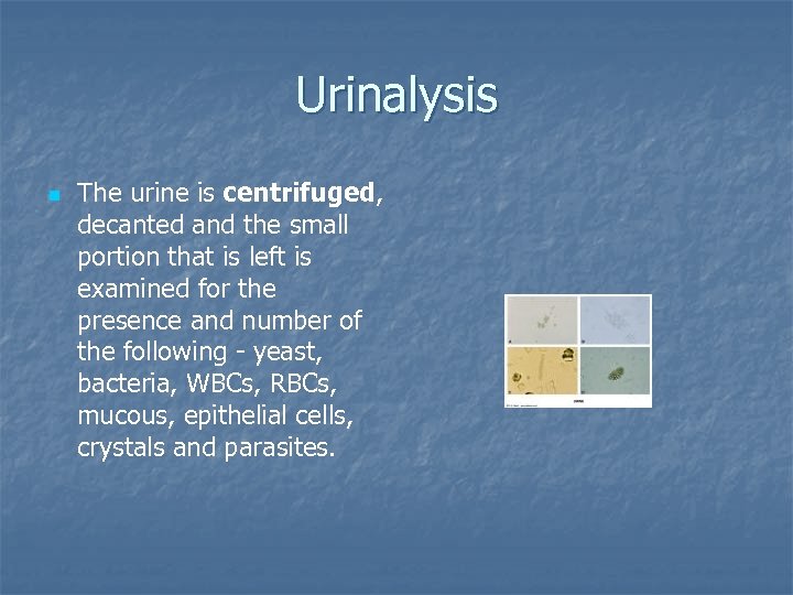 Urinalysis n The urine is centrifuged, decanted and the small portion that is left