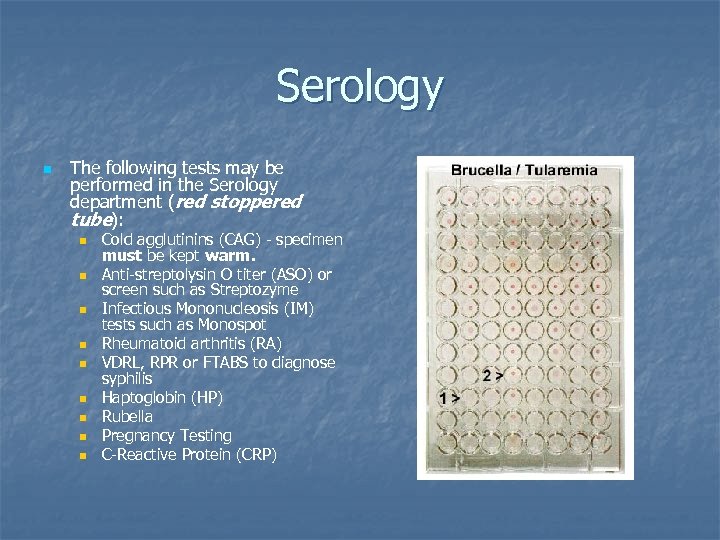 Serology n The following tests may be performed in the Serology department (red stoppered