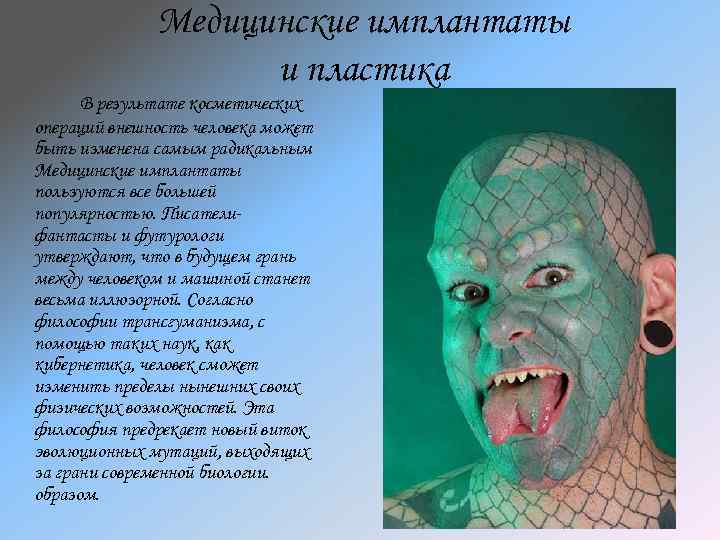 Медицинские имплантаты и пластика В результате косметических операций внешность человека может быть изменена самым