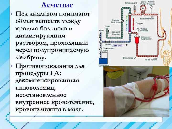 Лечение Под диализом понимают обмен веществ между кровью больного и диализирующим раствором, проходящий через