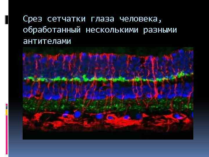 Срез сетчатки глаза человека, обработанный несколькими разными антителами 