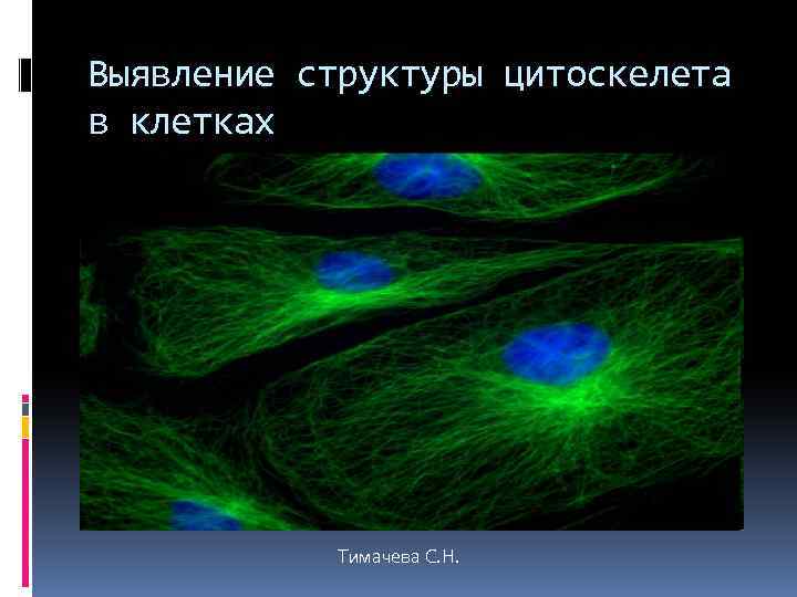 Выявление структуры цитоскелета в клетках Тимачева С. Н. 