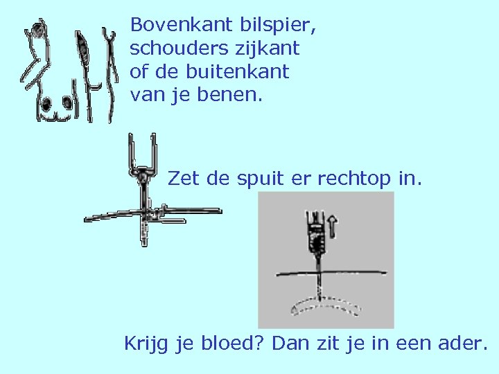 Bovenkant bilspier, schouders zijkant of de buitenkant van je benen. Zet de spuit er