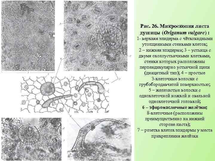 Рис. 26. Микроскопия листа душицы (Origanum vulgare) : 1 - верхняя эпидерма с чётковидными
