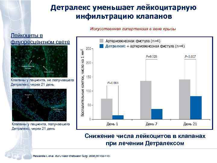 Детралекс уменьшает лейкоцитарную инфильтрацию клапанов Искусственная гипертензия в вене крысы Лейкоциты в флуоресцентном свете