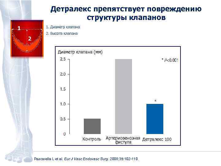 Детралекс препятствует повреждению структуры клапанов 1 1. Диаметр клапана 2 2. Высота клапана Диаметр