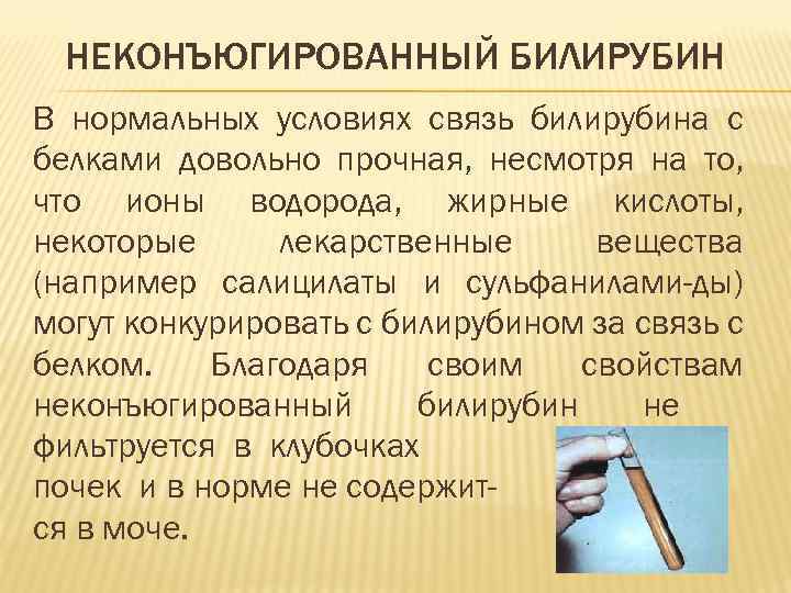 НЕКОНЪЮГИРОВАННЫЙ БИЛИРУБИН В нормальных условиях связь билирубина с белками довольно прочная, несмотря на то,