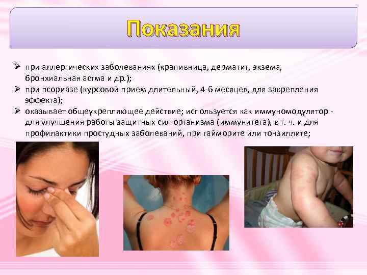 Показания Ø при аллергических заболеваниях (крапивница, дерматит, экзема, бронхиальная астма и др. ); Ø