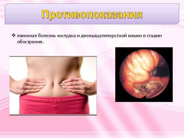 Противопоказания v язвенная болезнь желудка и двенадцатиперстной кишки в стадии обострения. 