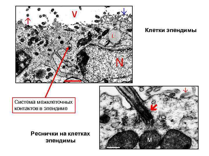 Клетки эпендимы Система межклеточных контактов в эпендиме Реснички на клетках эпендимы 
