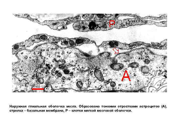 Наружная глиальная оболочка мозга. Образована тонкими отростками астроцитов (А), стрелка – базальная мембрана, Р