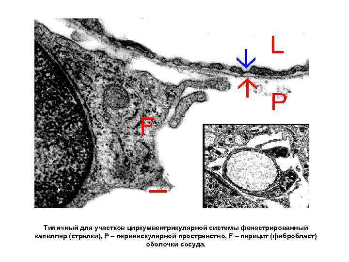 Типичный для участков циркумвентрикулярной системы фенестрированный капилляр (стрелки), Р – периваскулярной пространство, F –