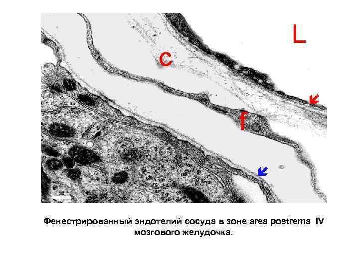 Фенестрированный эндотелий сосуда в зоне area postrema IV мозгового желудочка. 