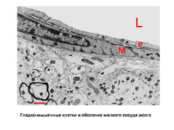 Гладко-мышечные клетки в оболочке мелкого сосуда мозга 
