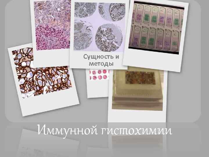 Сущность и методы Иммунной гистохимии 