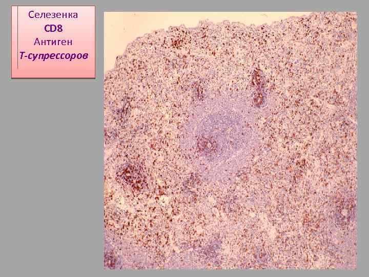 Селезенка CD 8 Антиген Т-супрессоров 
