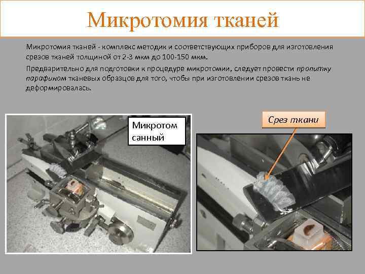 Микротомия тканей - комплекс методик и соответствующих приборов для изготовления срезов тканей толщиной от