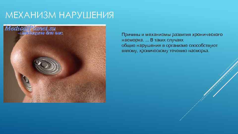 МЕХАНИЗМ НАРУШЕНИЯ Причины и механизмы развития хронического насморка. . В таких случаях общие нарушения