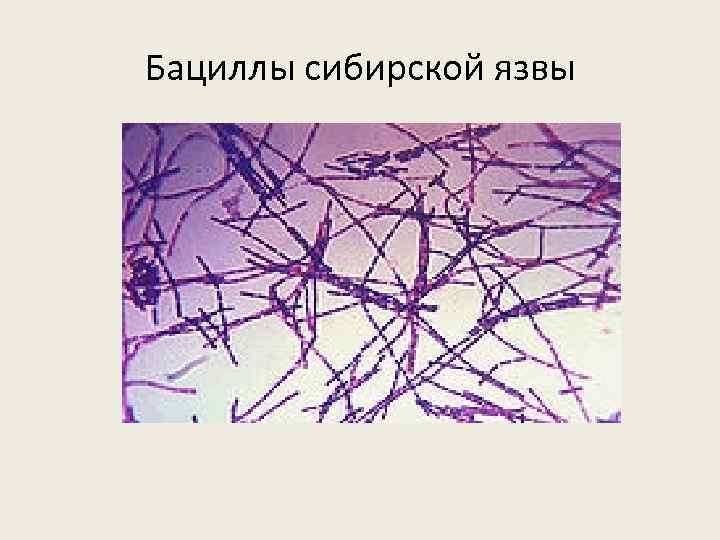 Бациллы сибирской язвы 
