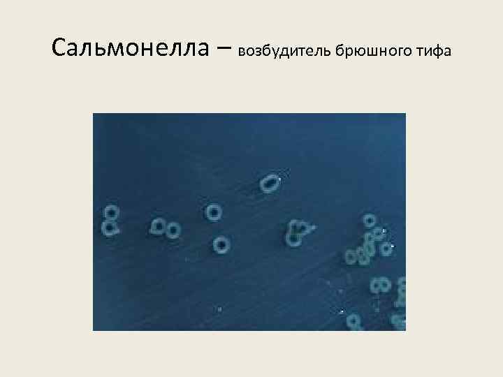 Сальмонелла – возбудитель брюшного тифа 