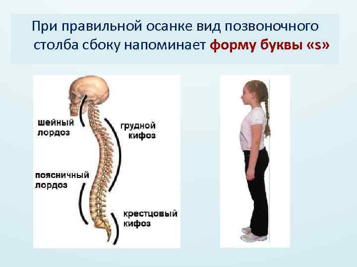 При правильной осанке вид позвоночного столба сбоку напоминает форму буквы «s» 