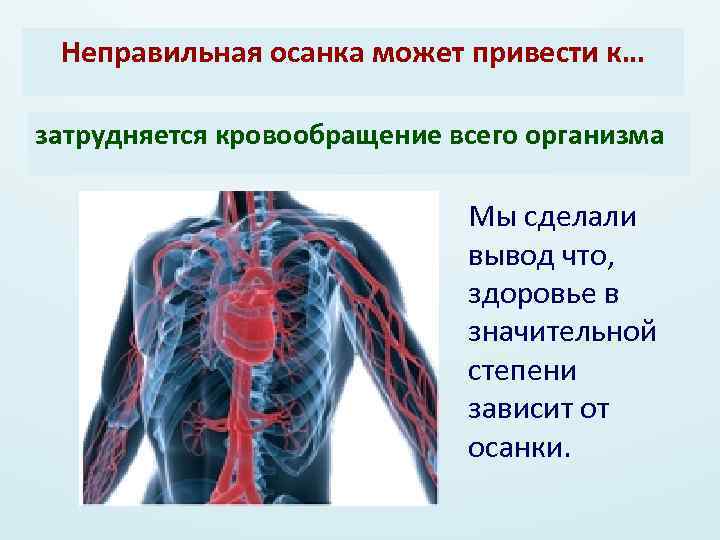 Неправильная осанка может привести к… затрудняется кровообращение всего организма Мы сделали вывод что, здоровье