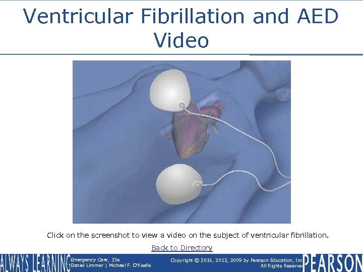 Ventricular Fibrillation and AED Video Click on the screenshot to view a video on