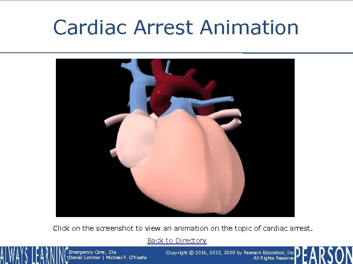 Cardiac Arrest Animation Click on the screenshot to view an animation on the topic