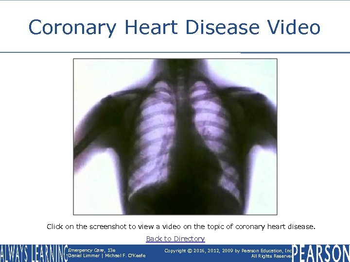Coronary Heart Disease Video Click on the screenshot to view a video on the