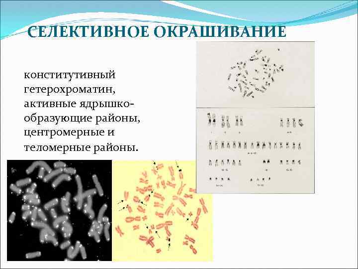 СЕЛЕКТИВНОЕ ОКРАШИВАНИЕ конститутивный гетерохроматин, активные ядрышкообразующие районы, центромерные и теломерные районы. 