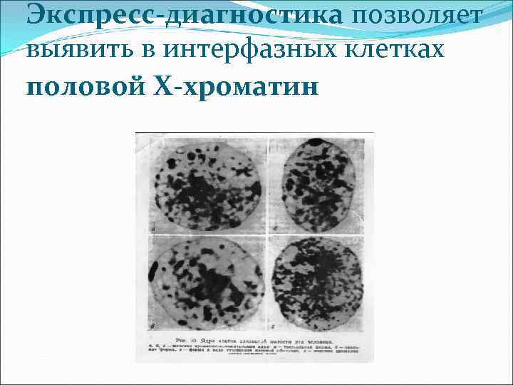 Экспресс-диагностика позволяет выявить в интерфазных клетках половой Х-хроматин 