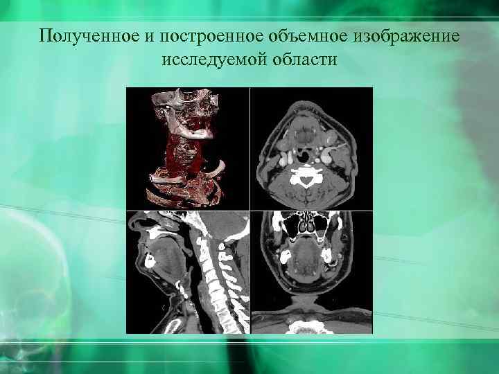 Полученное и построенное объемное изображение исследуемой области 