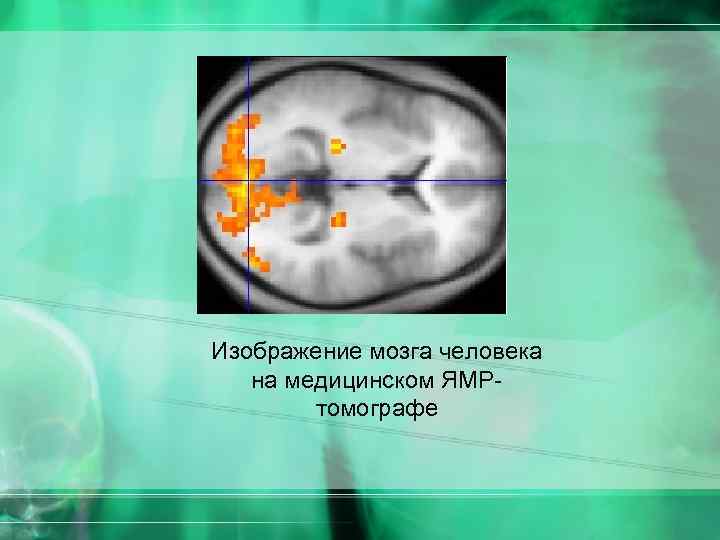 Изображение мозга человека на медицинском ЯМРтомографе 
